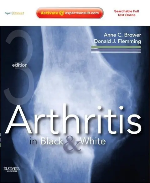 Cover: 9781416055952 | Arthritis in Black &amp; White | Anne C Brower (u. a.) | Buch | Gebunden