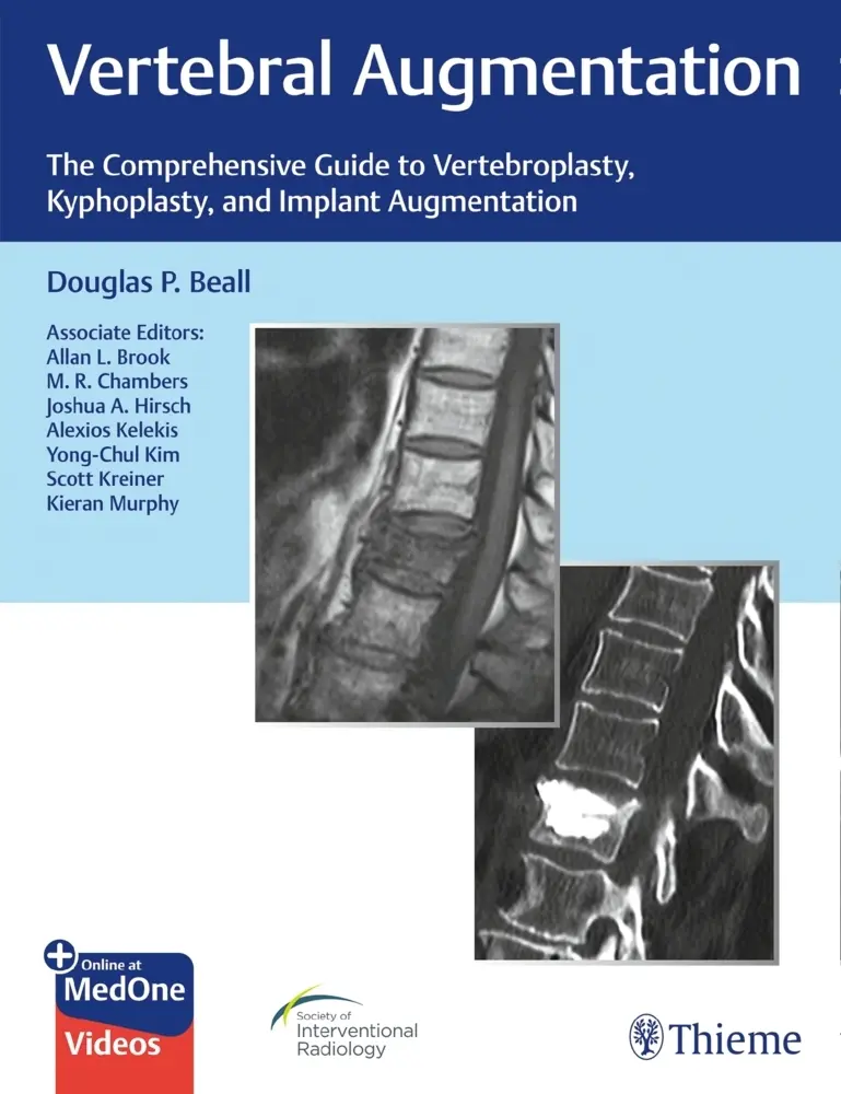 Cover: 9781684200153 | Vertebral Augmentation | Douglas P. Beall | Bundle | Englisch | 2020