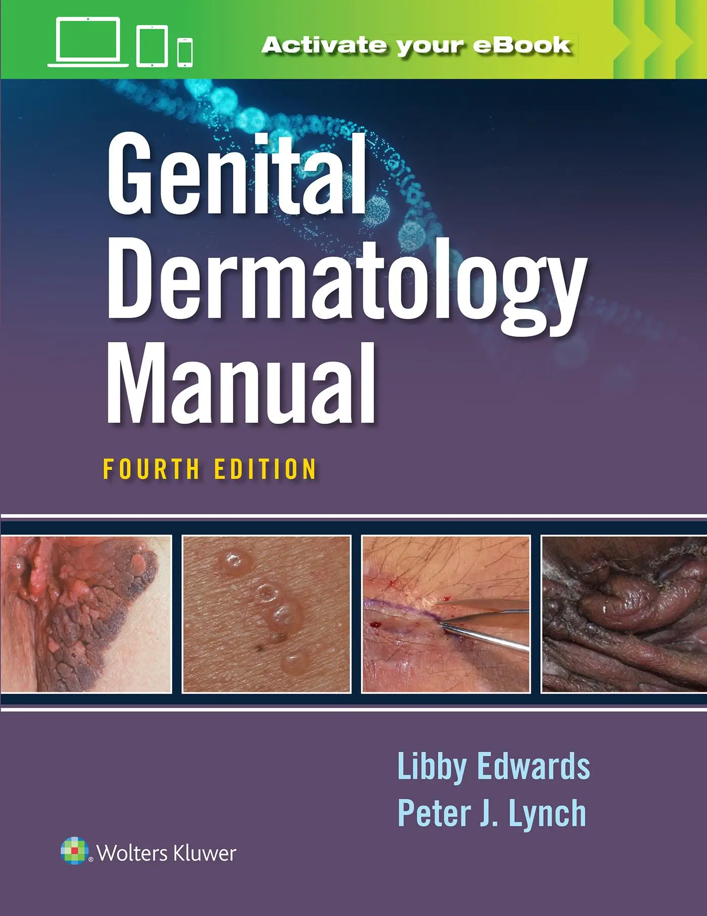 Cover: 9781975161453 | Genital Dermatology Manual | Libby Edwards (u. a.) | Taschenbuch