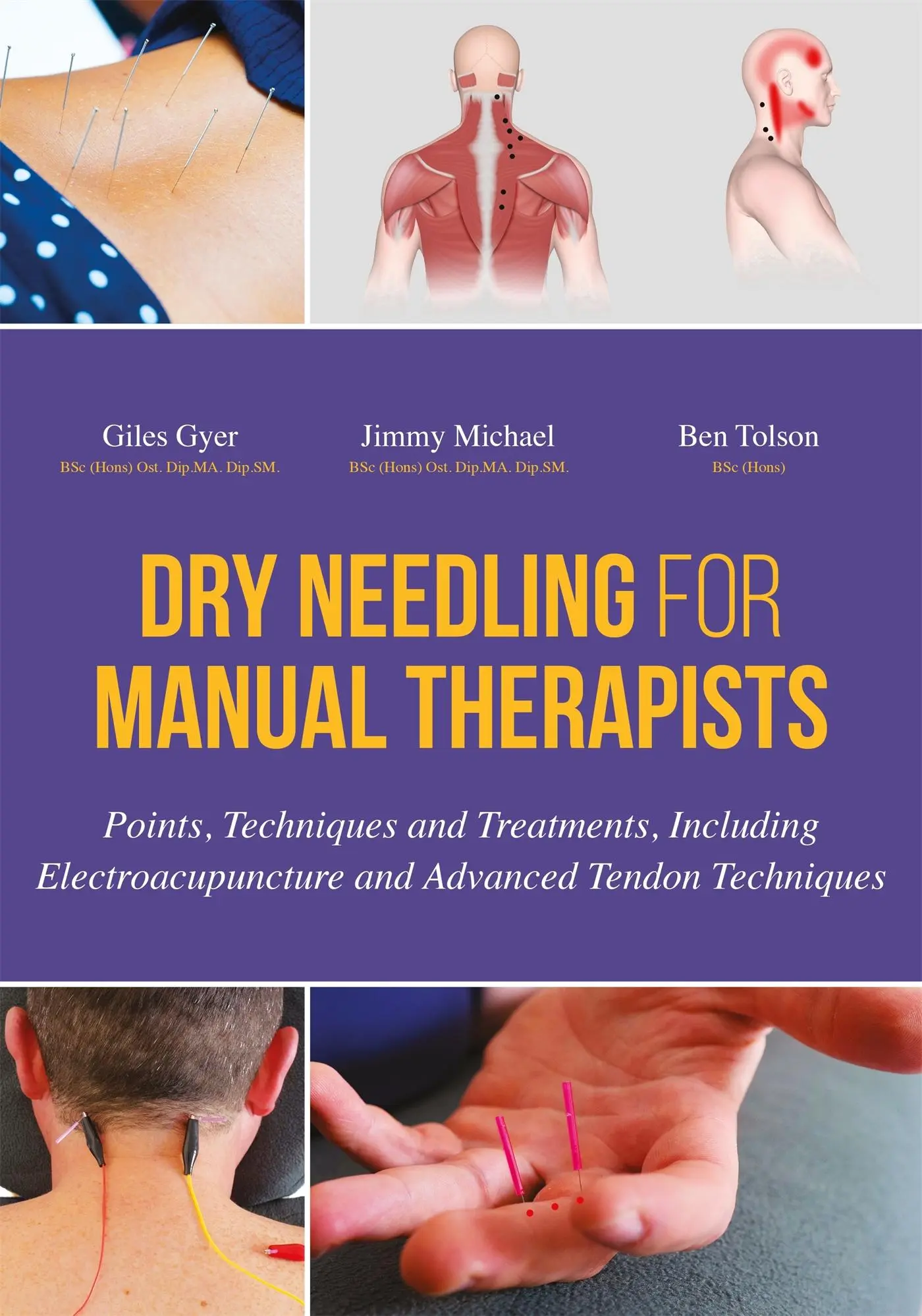 Cover: 9781848192553 | Dry Needling for Manual Therapists | Giles Gyer (u. a.) | Buch | 2016