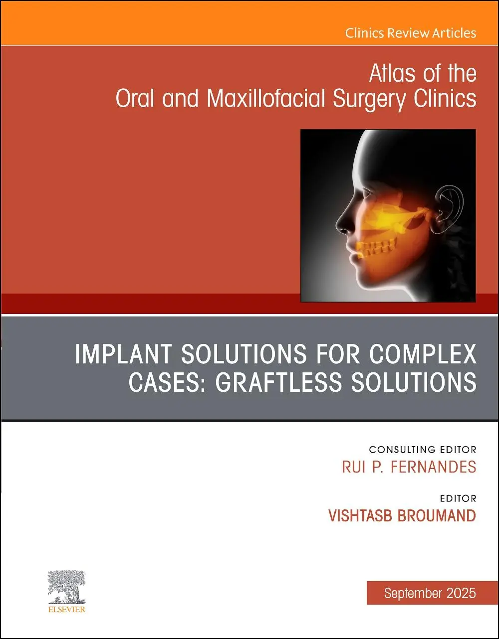 Cover: 9780443344053 | Implant Solutions for Complex Cases: Graftless Solutions, an Issue...