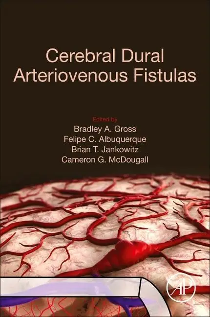 Cover: 9780128195253 | Cerebral Dural Arteriovenous Fistulas | Bradley A. Gross (u. a.)