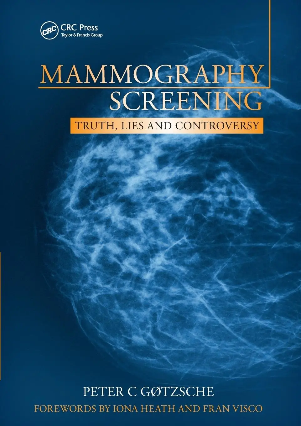 Cover: 9781846195853 | Mammography Screening | Truth, Lies and Controversy | Peter Gotzsche