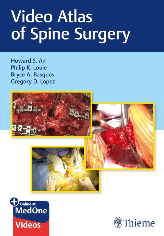 Cover: 9781684200054 | Video Atlas of Spine Surgery | Mit E-Book | Howard S. An (u. a.)