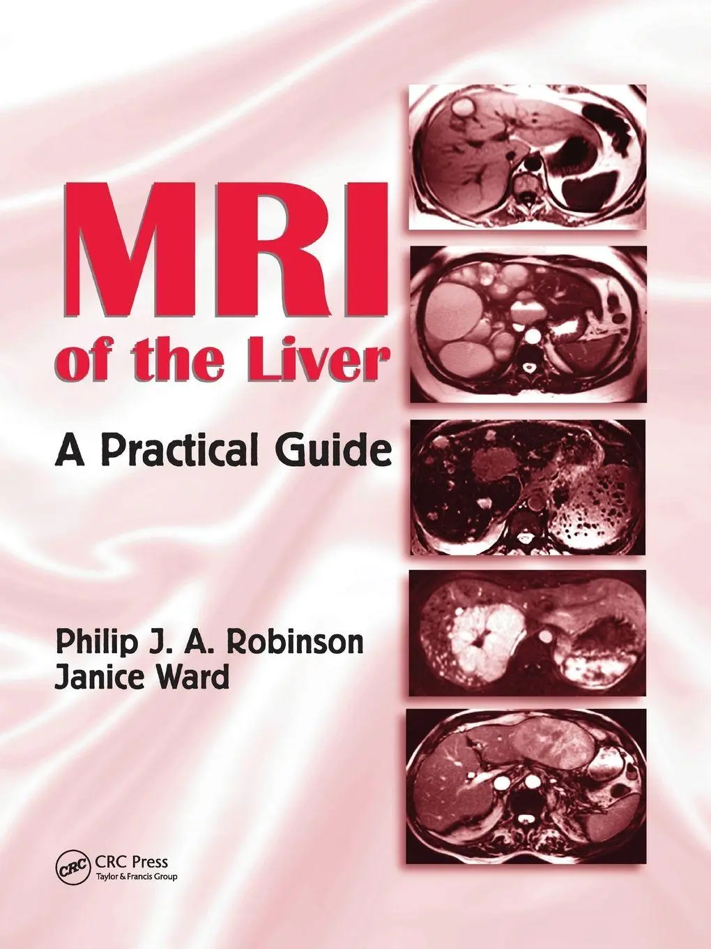 Cover: 9780367390754 | MRI of the Liver | A Practical Guide | Philip J. A. Robinson (u. a.)