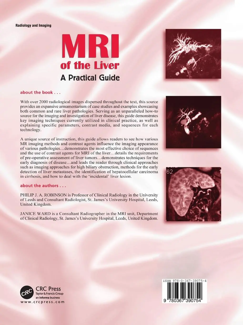Rückseite: 9780367390754 | MRI of the Liver | A Practical Guide | Philip J. A. Robinson (u. a.)