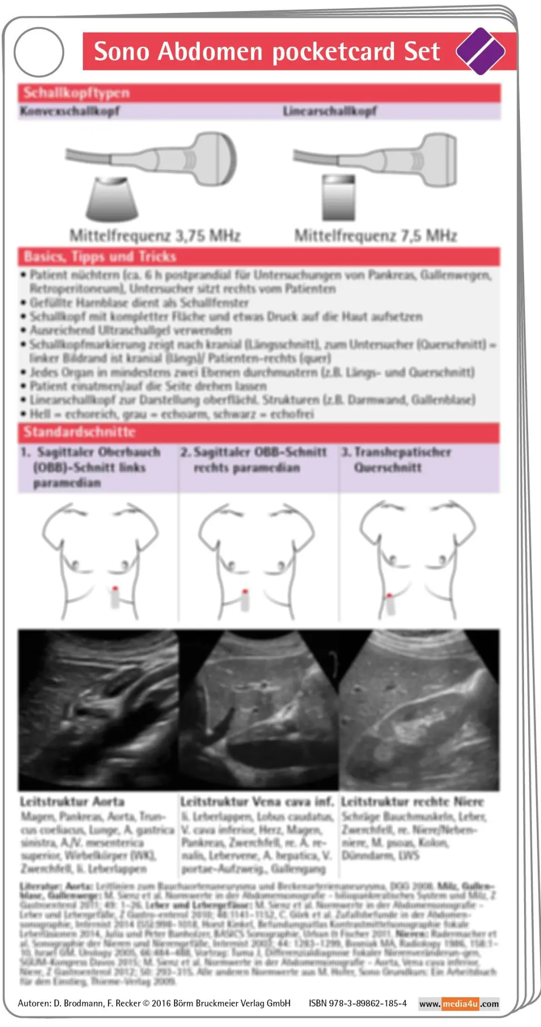 Cover: 9783898621854 | Sono Abdomen pocketcard Set | Doreen Brodmann (u. a.) | Taschenbuch