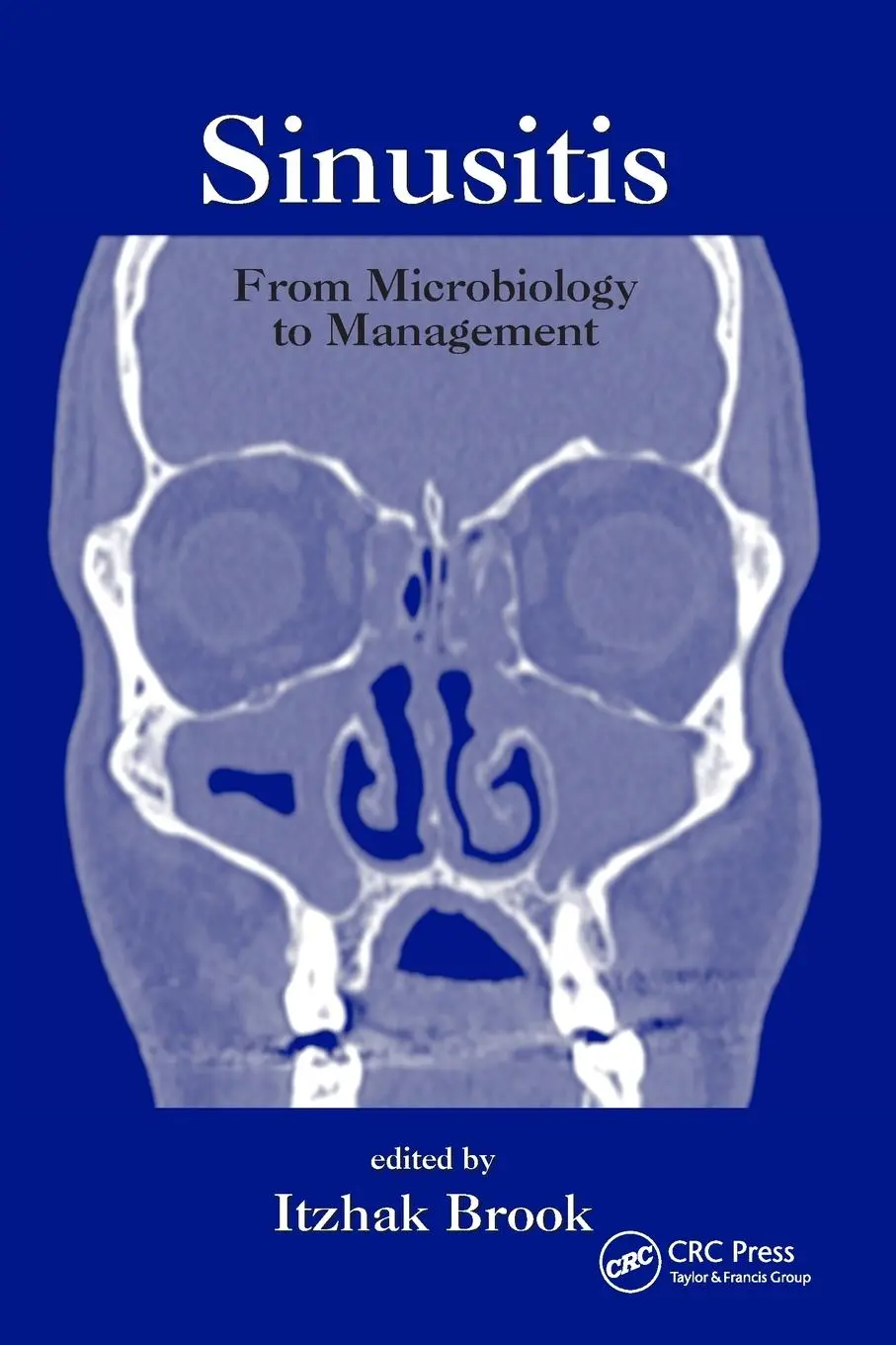 Cover: 9780367392154 | Sinusitis | From Microbiology to Management | Itzhak Brook | Buch
