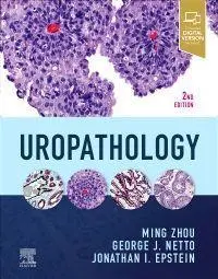 Cover: 9780323653954 | Uropathology | Ming Zhou (u. a.) | Buch | Englisch | 2022