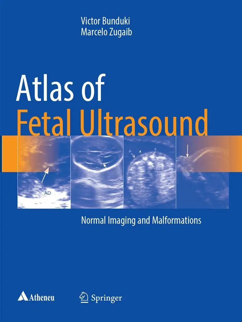 Cover: 9783319854854 | Atlas of Fetal Ultrasound | Normal Imaging and Malformations | Buch