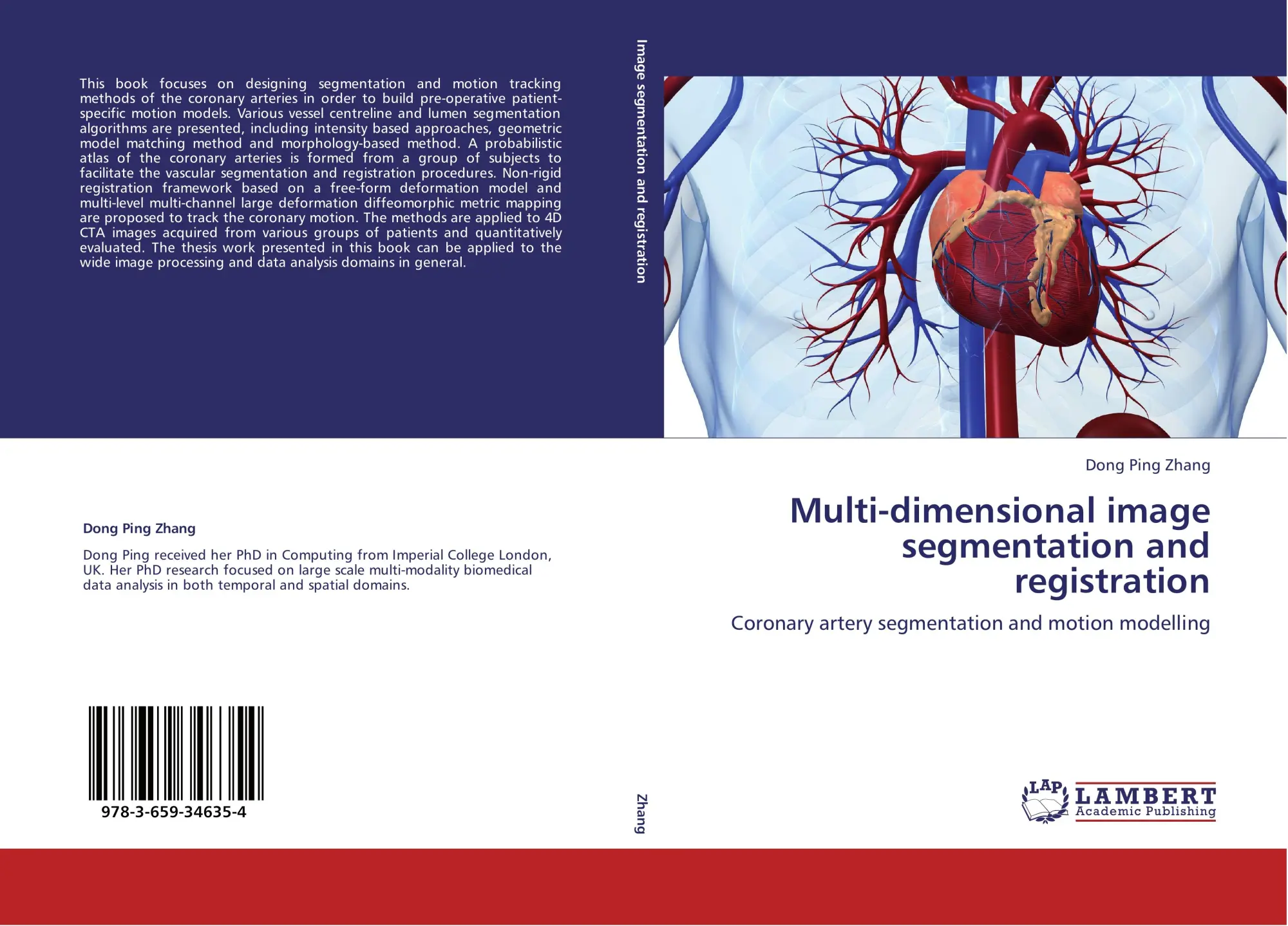 Cover: 9783659346354 | Multi-dimensional image segmentation and registration | Zhang | Buch