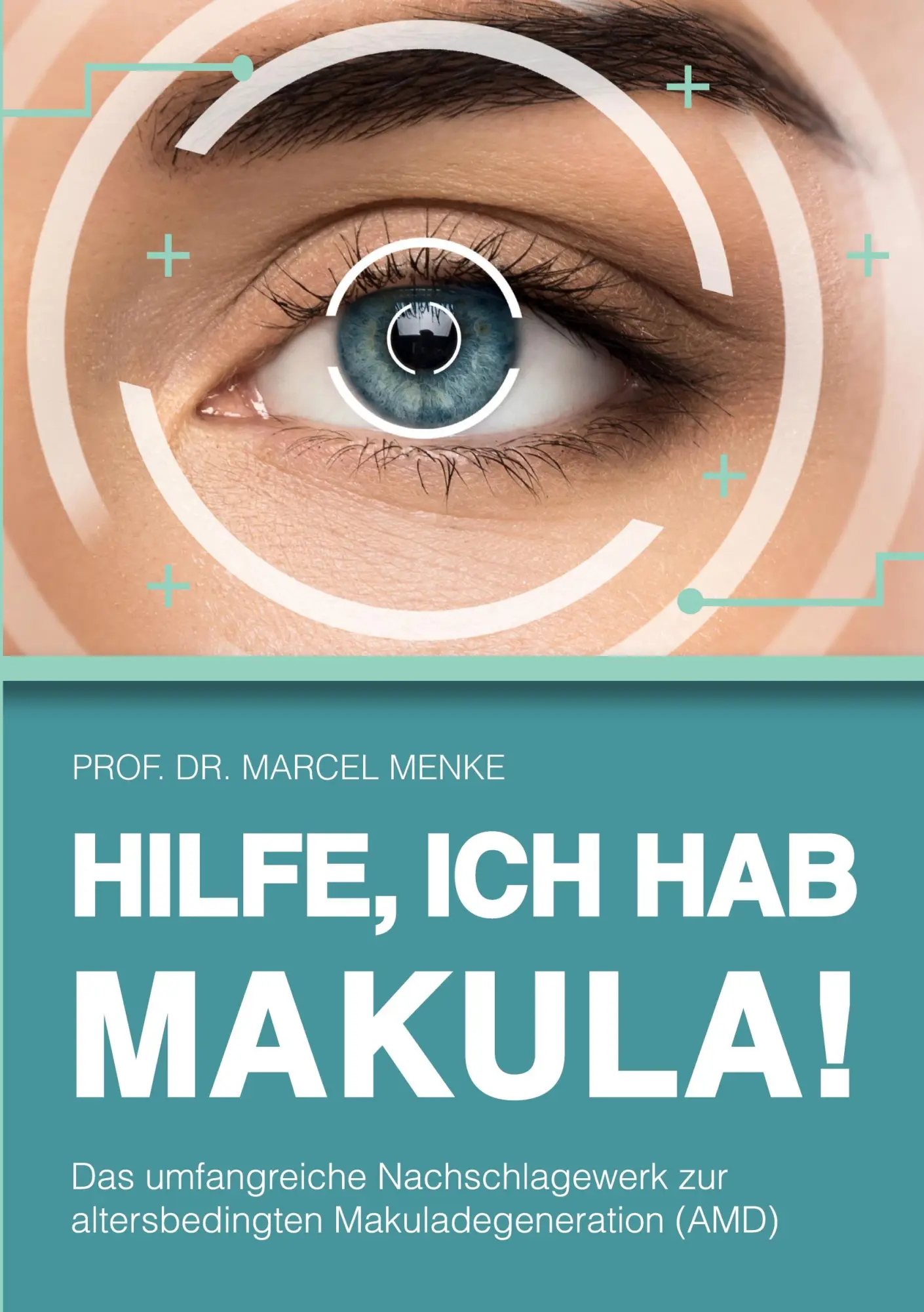 Cover: 9783769376654 | Hilfe! Ich hab Makula | Marcel Menke | Taschenbuch | 308 S. | Deutsch