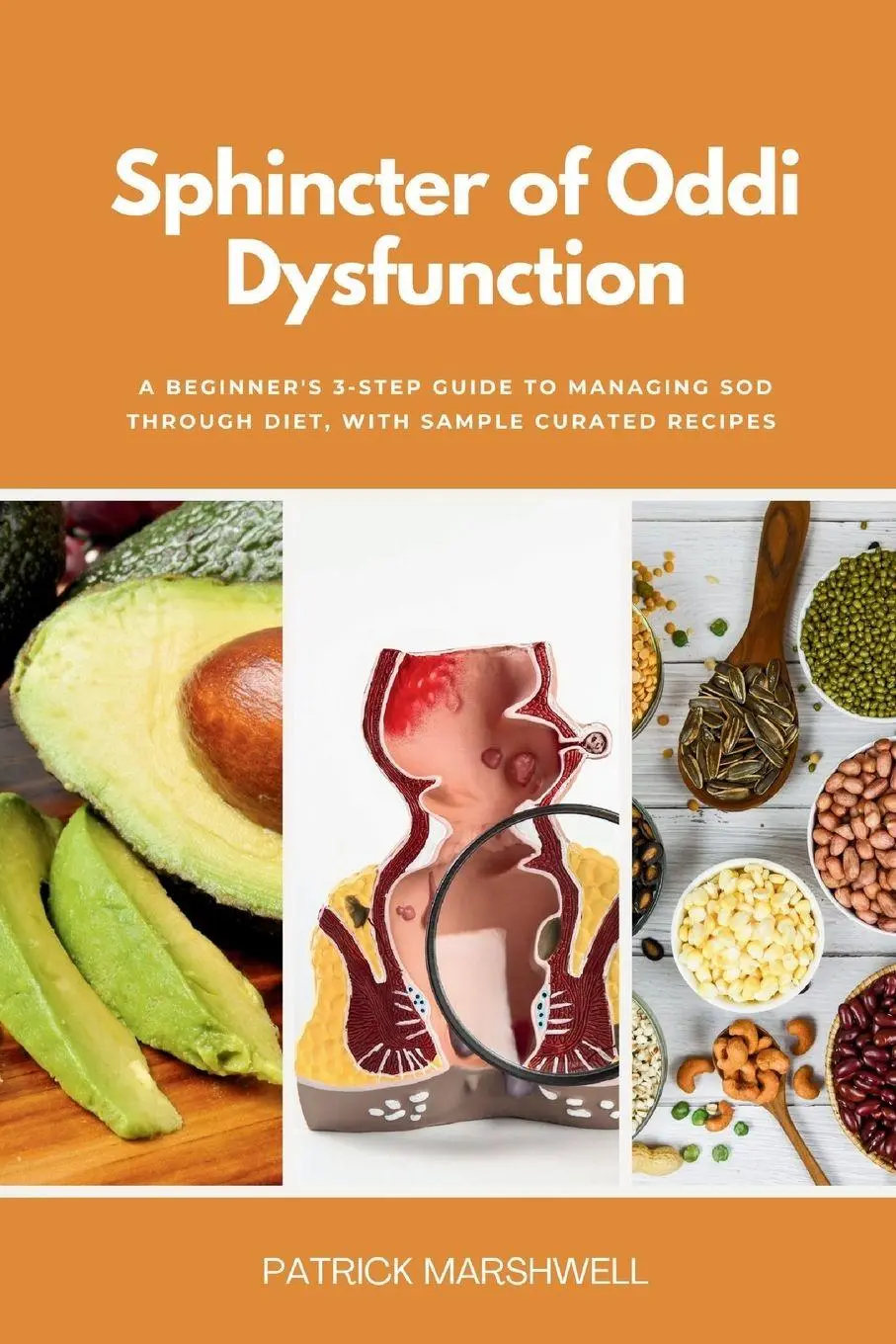 Cover: 9798868908354 | Sphincter of Oddi Dysfunction | Patrick Marshwell | Taschenbuch | 2023
