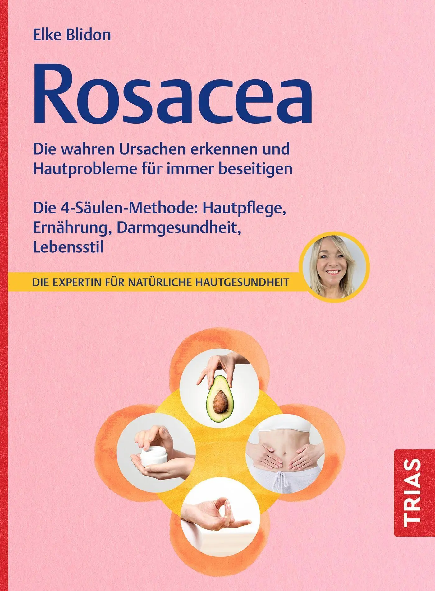 Cover: 9783432120355 | Rosacea | Elke Blidon | Taschenbuch | 176 S. | Deutsch | 2025 | TRIAS