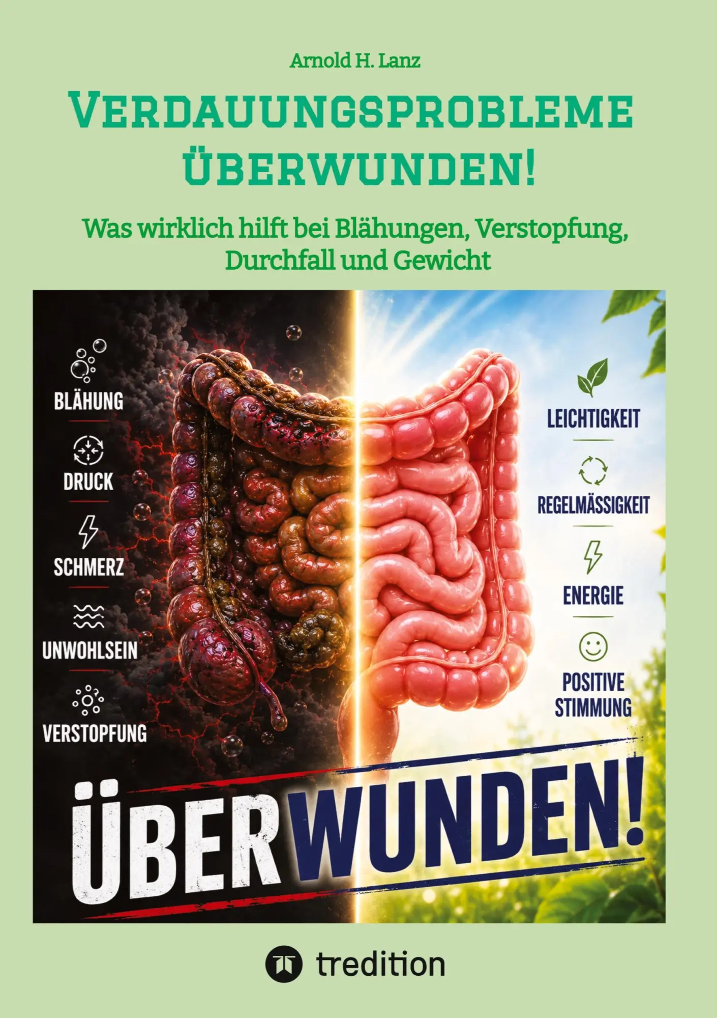 Cover: 9783384910455 | Verdauungsprobleme überwunden! | Arnold H. Lanz | Taschenbuch | 136 S.
