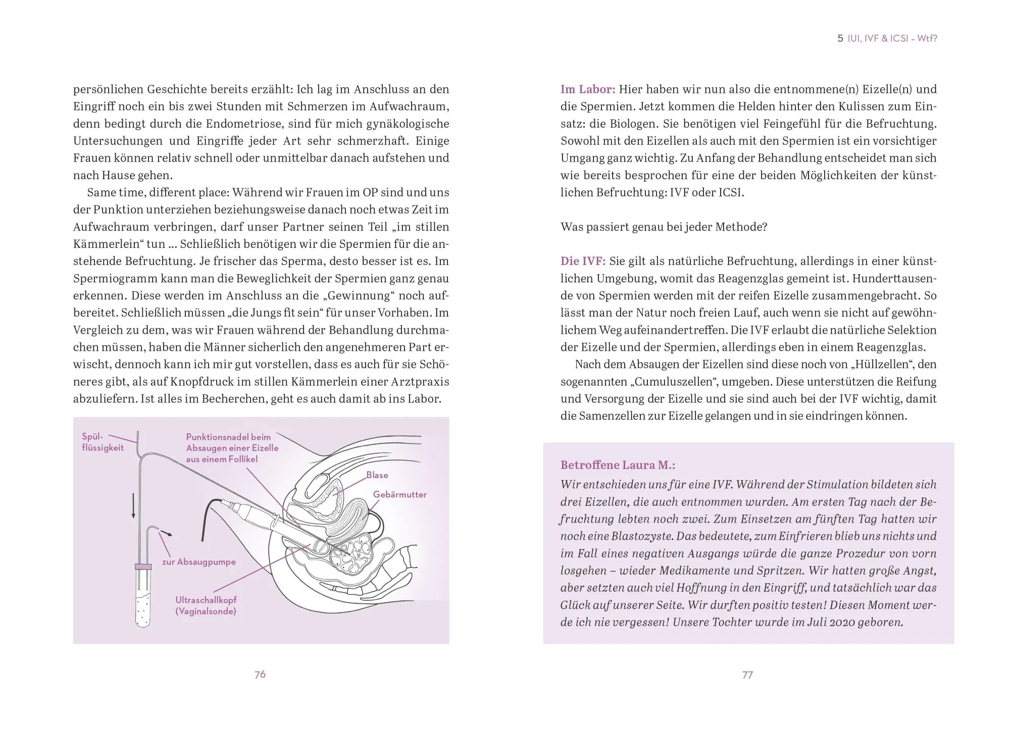 Bild: 9783965841055 | Na, wann ist es denn so weit? | Anna Wilken (u. a.) | Taschenbuch | ZS