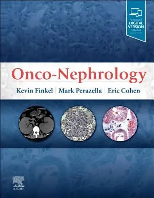 Cover: 9780323549455 | Onco-Nephrology | Kevin W Finkel (u. a.) | Buch | Englisch | 2019