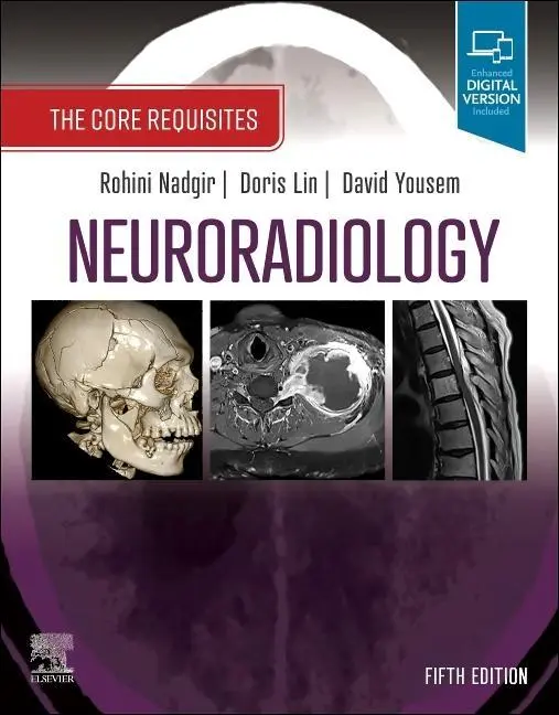 Cover: 9780323759755 | Neuroradiology | The Core Requisites | Rohini Nadgir (u. a.) | Buch Cover: 9780323759755 | Neuroradiology | The Core Requisites | Rohini Nadgir (u. a.) | Buch