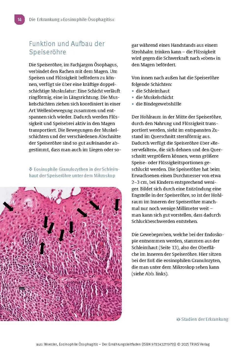 Bild: 9783432119755 | Eosinophile Ösophagitis - Der Ernährungsleitfaden | Woesler (u. a.)