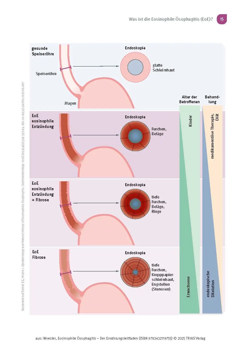 Bild: 9783432119755 | Eosinophile Ösophagitis - Der Ernährungsleitfaden | Woesler (u. a.)