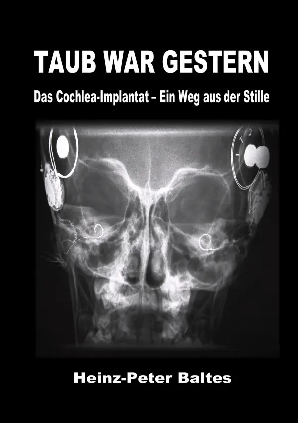 Cover: 9783819030956 | Taub war gestern | Das Cochlea-Implantat - Ein Weg aus der Stille. DE