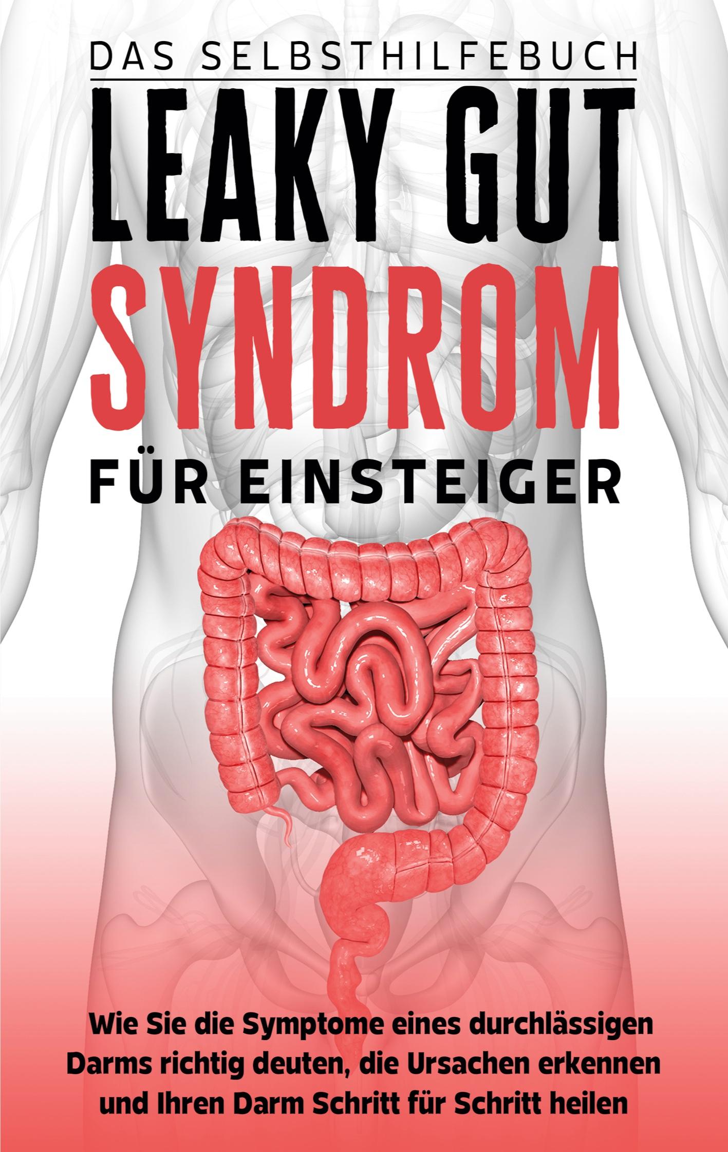 Cover: 9783756861156 | Leaky Gut Syndrom für Einsteiger - Das Selbsthilfebuch | Beckonert