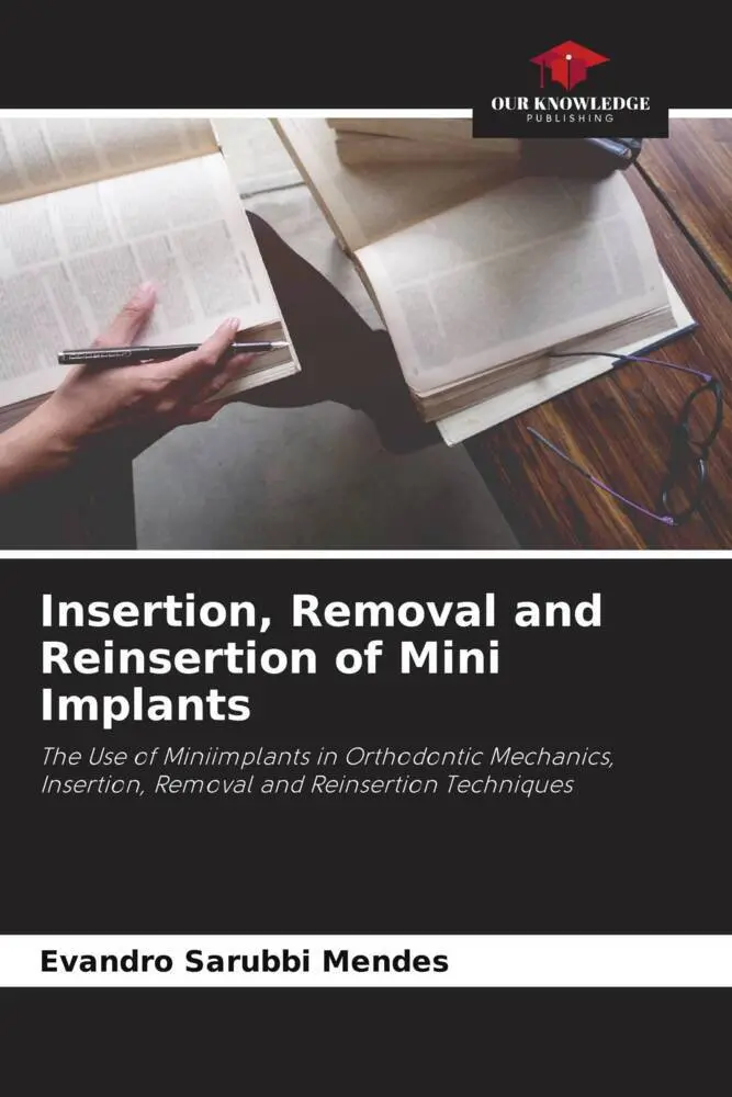 Cover: 9786206194156 | Insertion, Removal and Reinsertion of Mini Implants | Mendes | Buch
