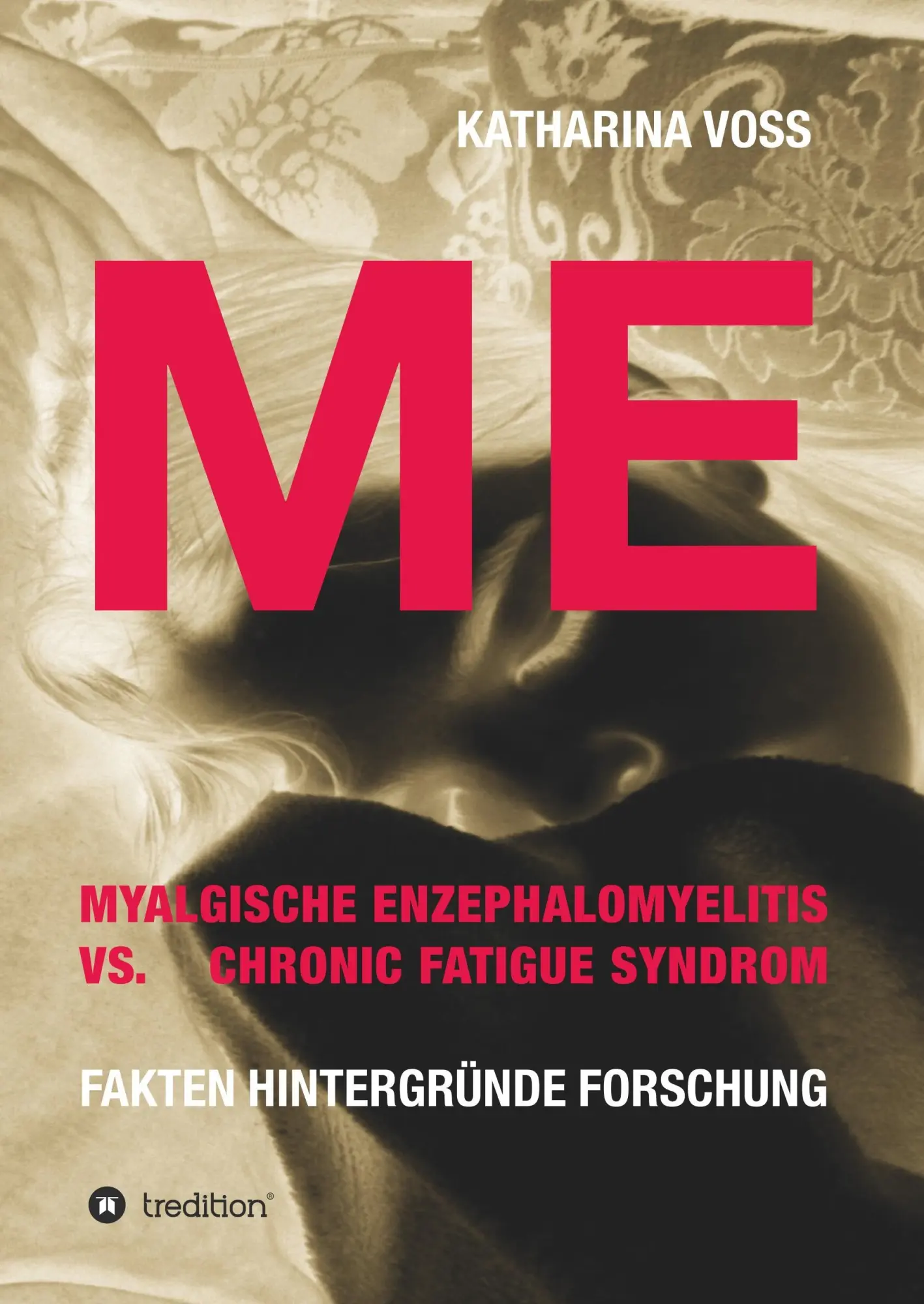 Cover: 9783743924956 | ME - Myalgische Enzephalomyelitis vs. Chronic Fatigue Syndrom | Voss