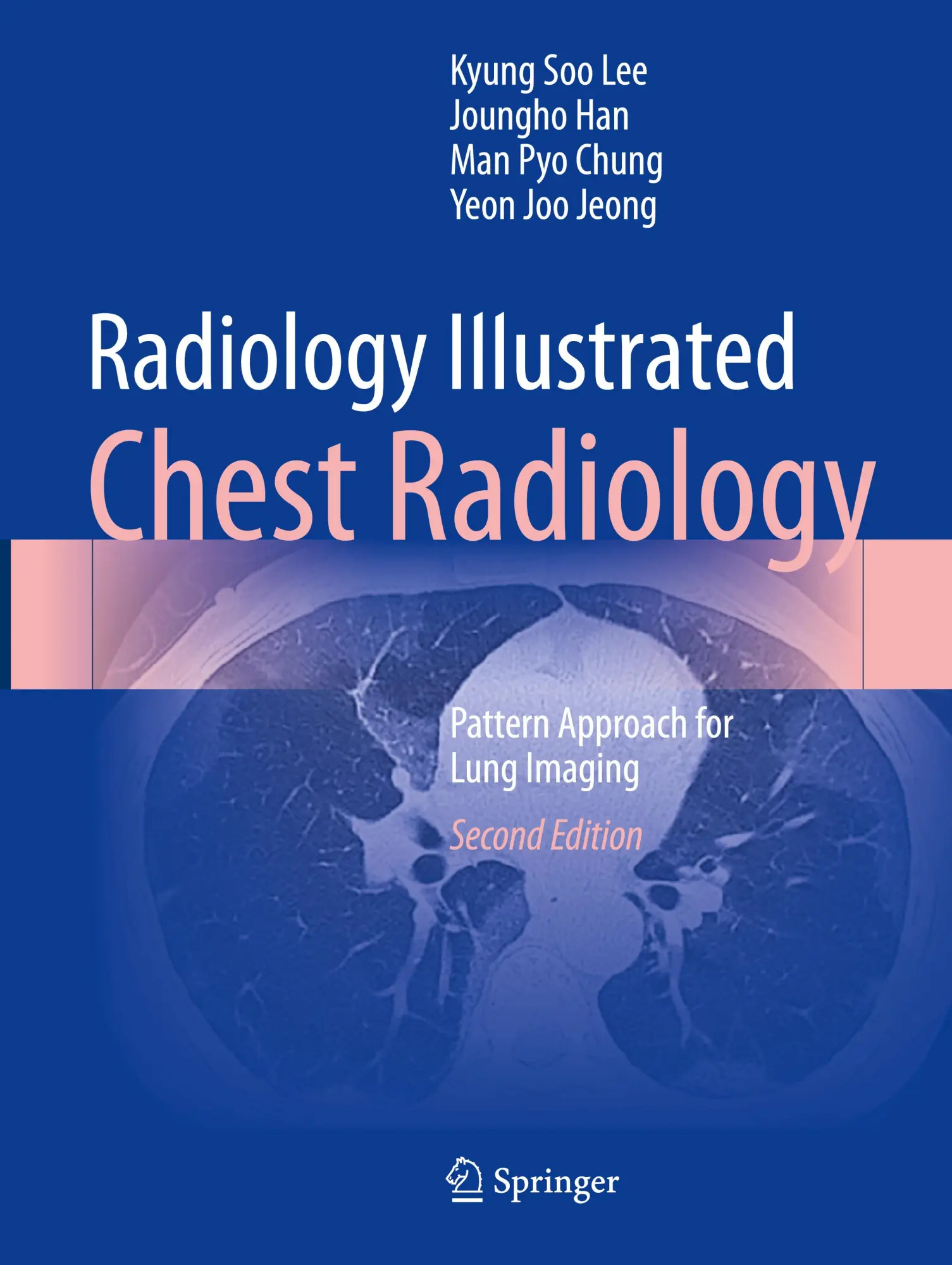 Cover: 9789819966356 | Radiology Illustrated: Chest Radiology | Kyung Soo Lee (u. a.) | Buch