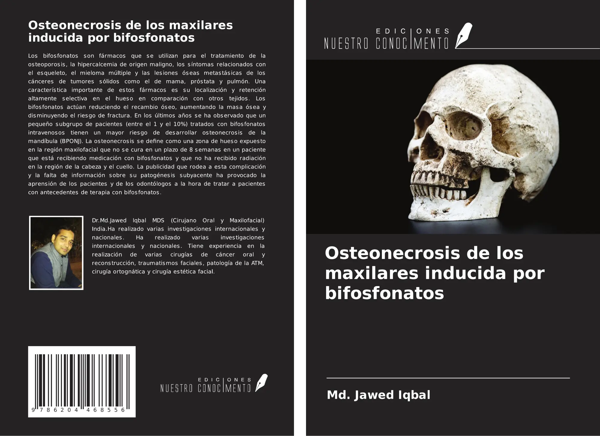 Cover: 9786204468556 | Osteonecrosis de los maxilares inducida por bifosfonatos | Iqbal
