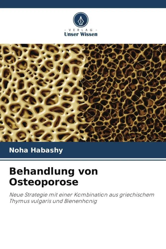 Cover: 9786204918556 | Behandlung von Osteoporose | Noha Habashy | Taschenbuch | 68 S. | 2022