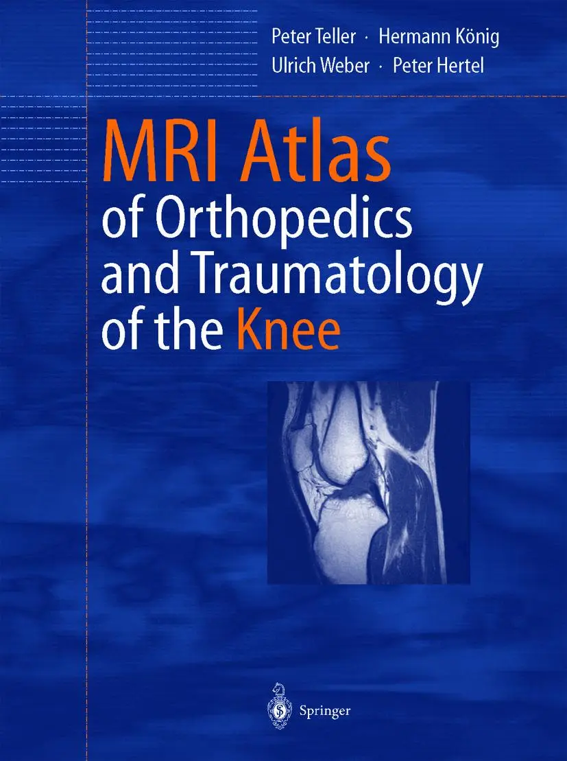 Cover: 9783642628856 | MRI Atlas of Orthopedics and Traumatology of the Knee | Teller (u. a.)