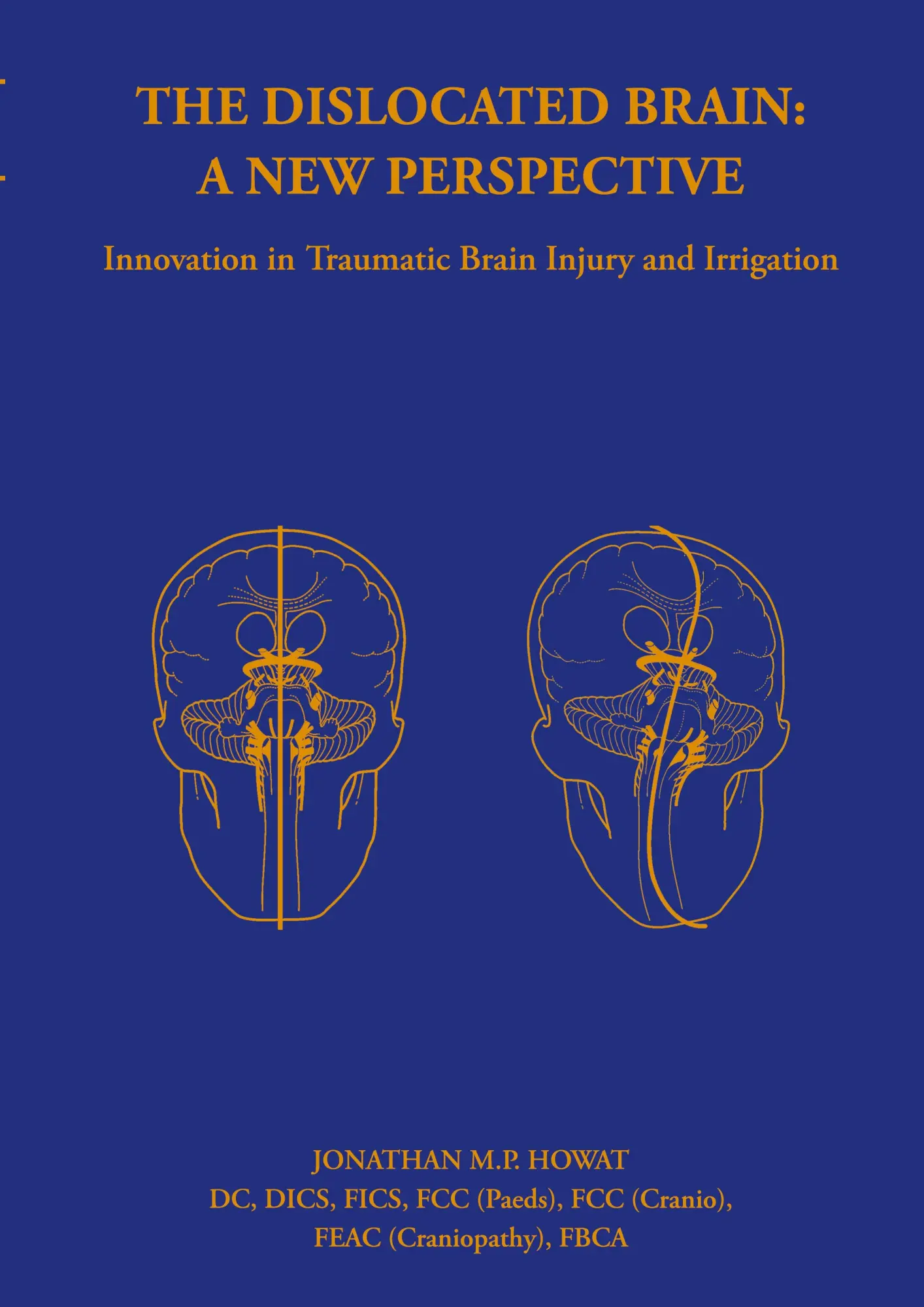 Cover: 9781999329556 | The Dislocated Brain | A New Perspective | Jonathan Howat | Buch