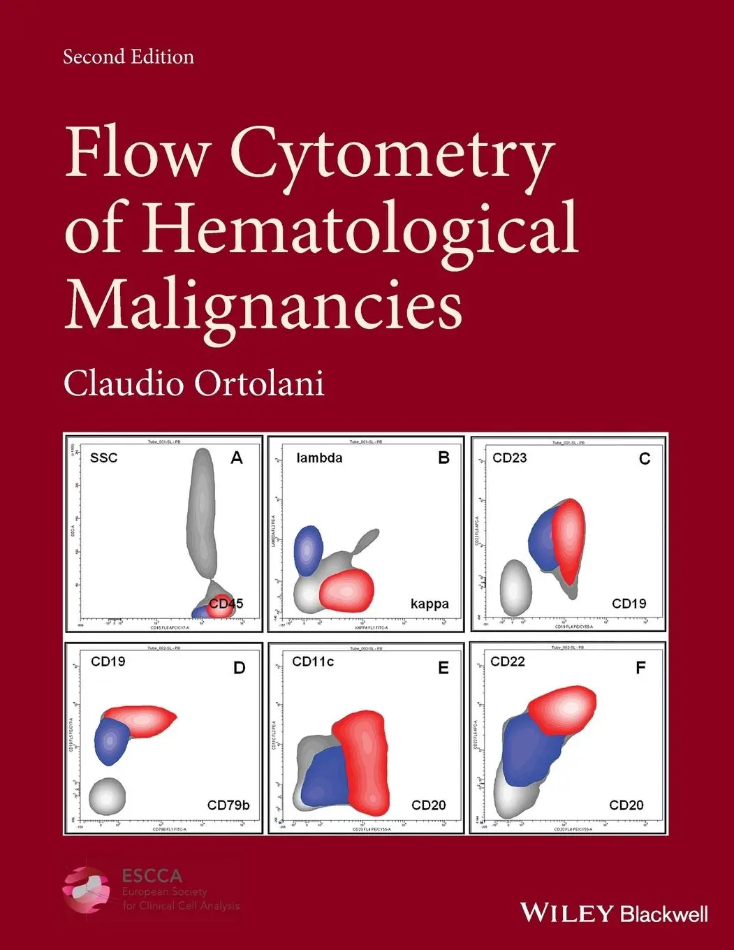 Cover: 9781119611257 | Flow Cytometry of Hematological Malignacies | Claudio Ortolani | Buch Cover: 9781119611257 | Flow Cytometry of Hematological Malignacies | Claudio Ortolani | Buch