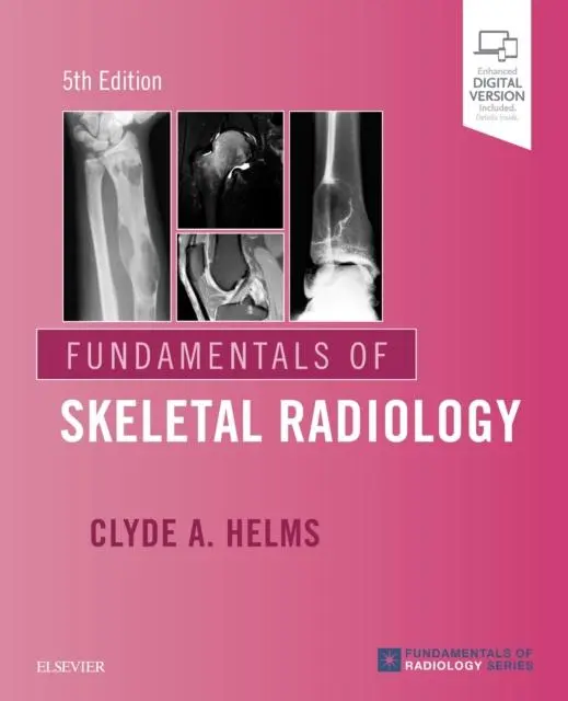 Cover: 9780323611657 | Fundamentals of Skeletal Radiology | Clyde A. Helms | Taschenbuch