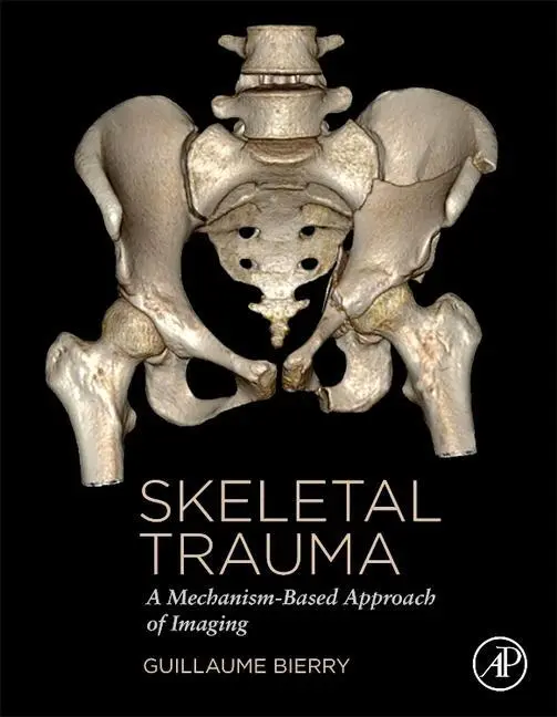 Cover: 9780323854757 | Skeletal Trauma | A Mechanism-Based Approach of Imaging | Bierry