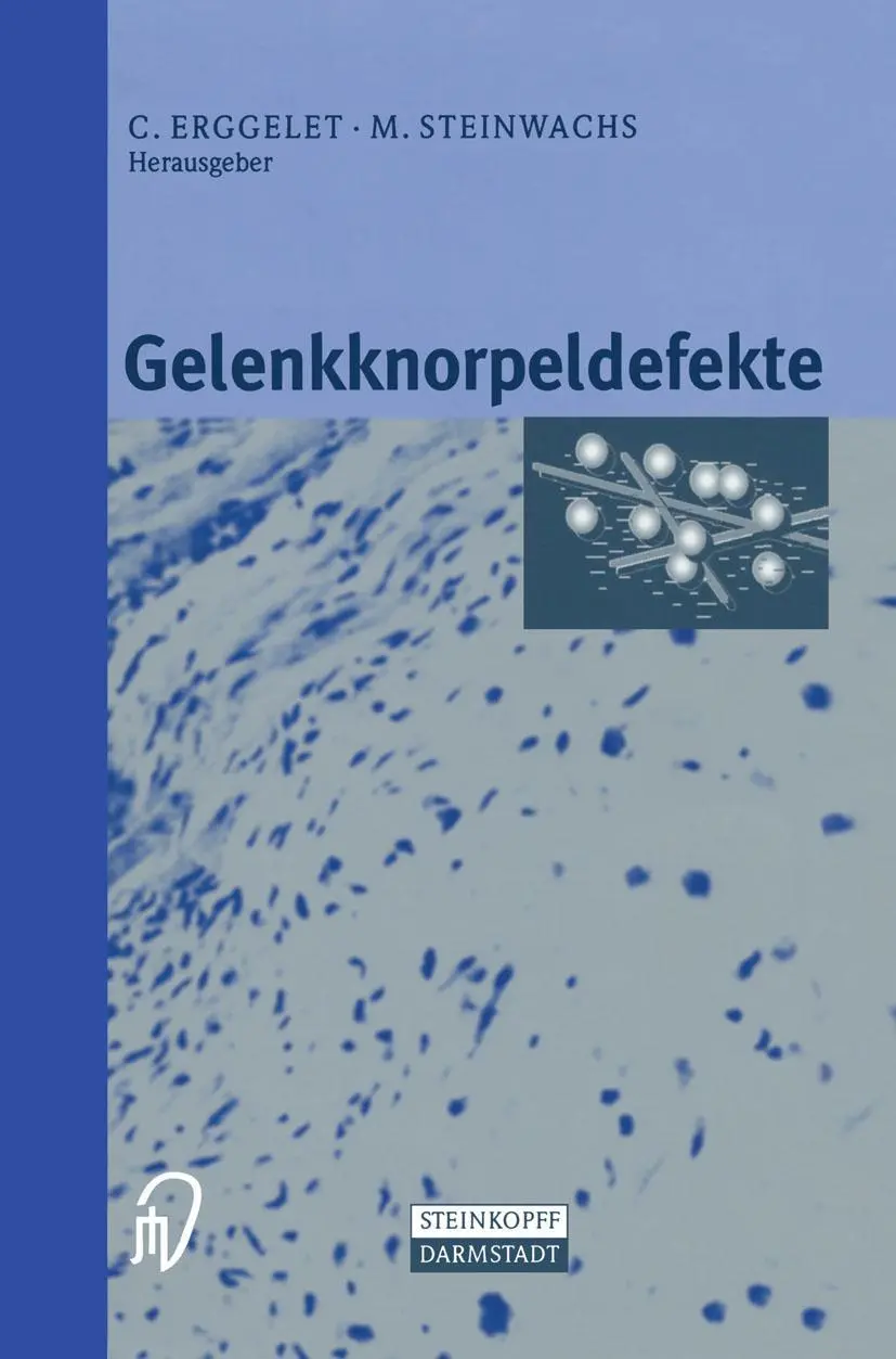 Cover: 9783798512658 | Gelenkknorpeldefekte | M. Steinwachs (u. a.) | Taschenbuch | x | 2001
