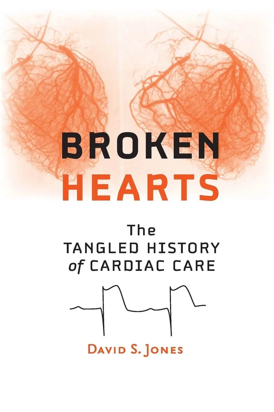 Cover: 9781421415758 | Broken Hearts | The Tangled History of Cardiac Care | David S. Jones
