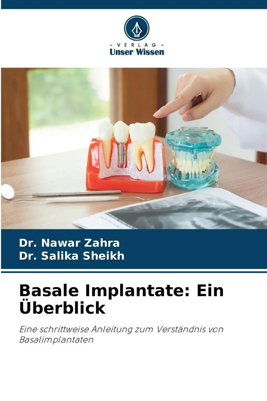 Cover: 9786208465858 | Basale Implantate: Ein Überblick | Nawar Zahra (u. a.) | Taschenbuch