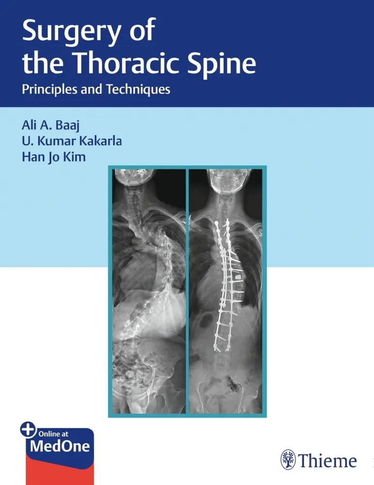 Cover: 9781626238558 | Surgery of the Thoracic Spine | Ali A. Baaj (u. a.) | Bundle | 1 eBook