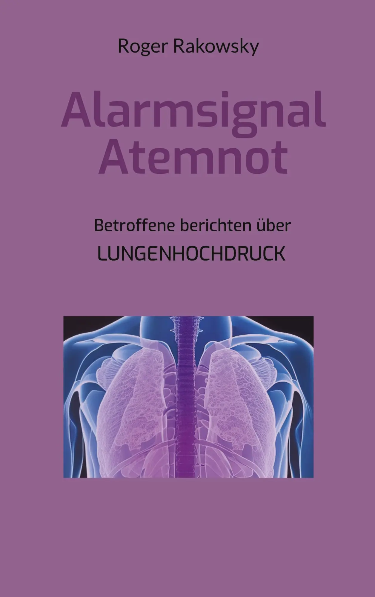 Cover: 9783757878658 | Alarmsignal Atemnot | Betroffene berichten über Lungenhochdruck | Buch