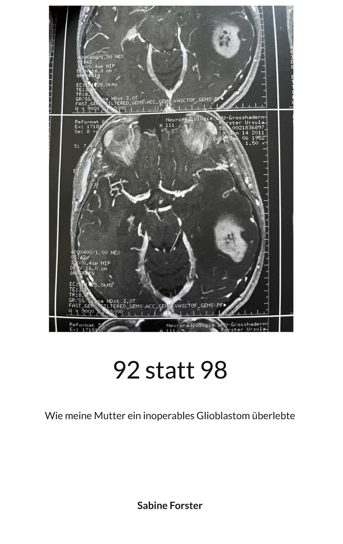 Cover: 9783755759058 | 92 statt 98 | Wie meine Mutter ein inoperables Glioblastom überlebte
