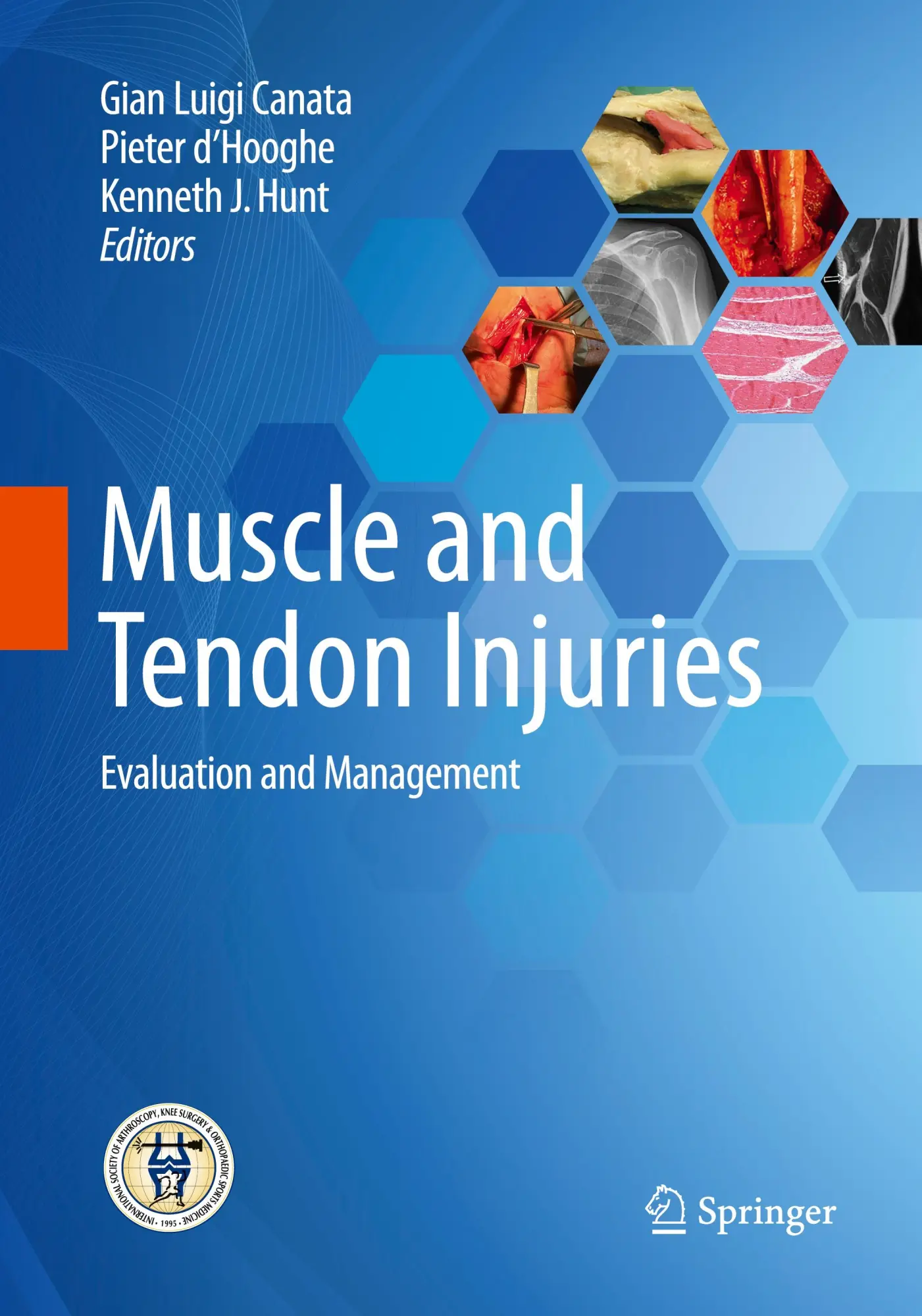 Cover: 9783662571859 | Muscle and Tendon Injuries | Evaluation and Management | Taschenbuch