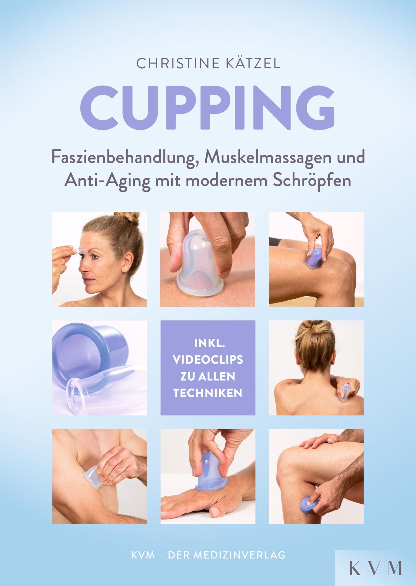 Cover: 9783868674859 | Cupping | Christine Kätzel | Taschenbuch | 144 S. | Deutsch | 2019