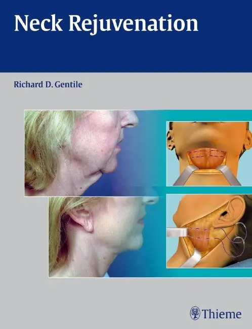Cover: 9781604060560 | Neck Rejuvenation | Richard D Gentile | Buch | 200 S. | Englisch