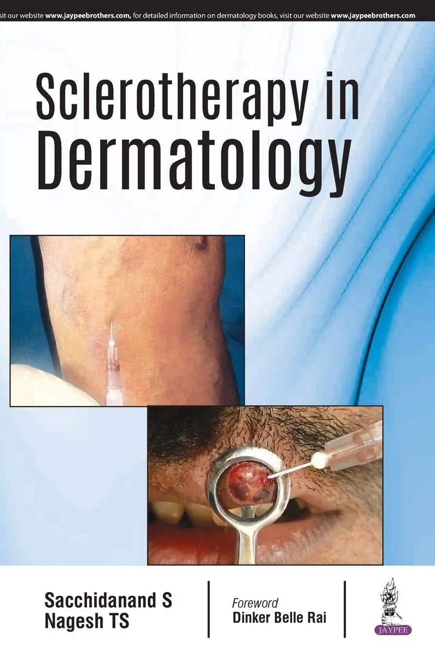 Cover: 9789352702060 | Sclerotherapy in Dermatology | Sacchidanand S (u. a.) | Taschenbuch