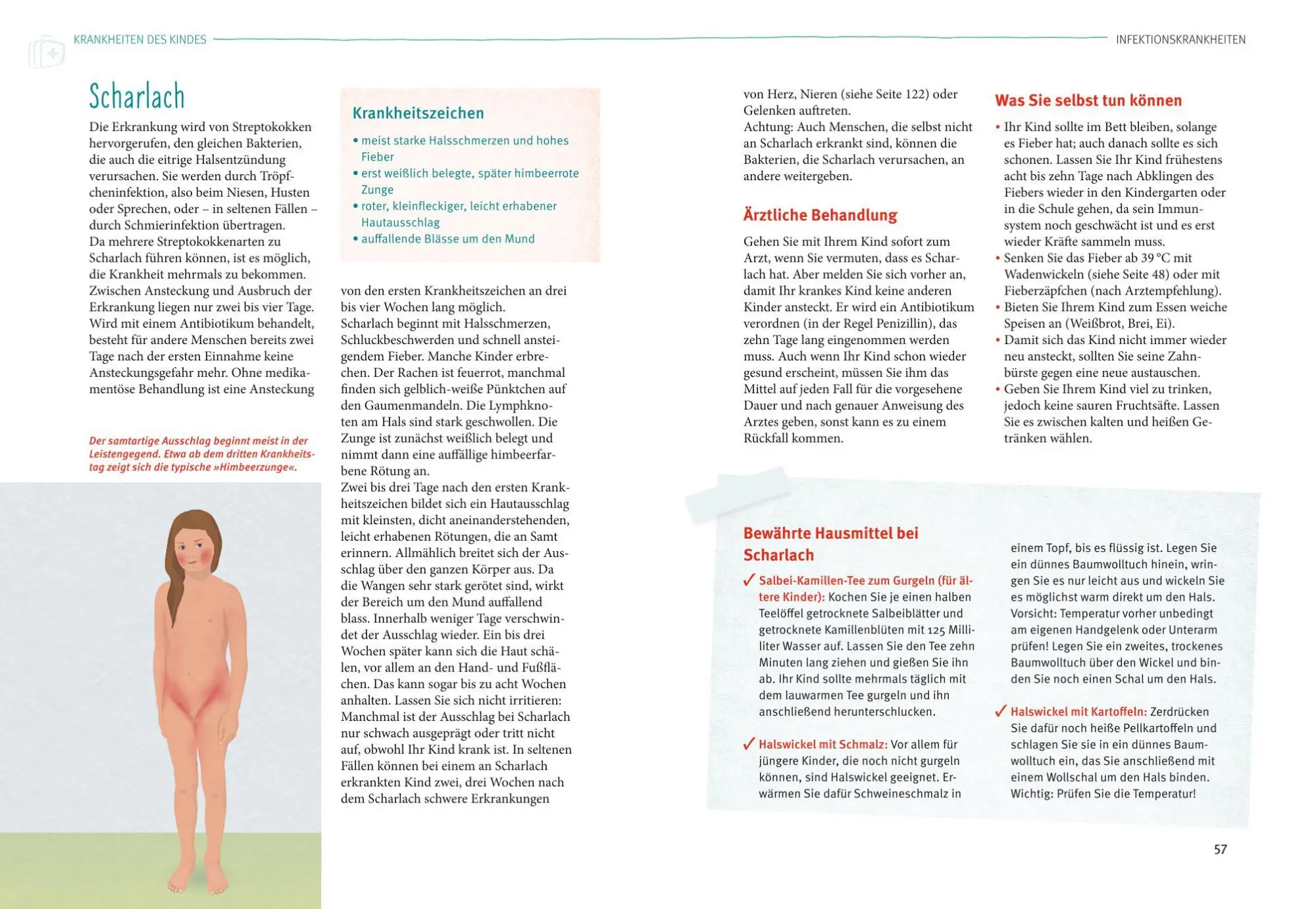 Bild: 9783833844560 | Kinderkrankheiten | Alles, was wichtig ist | Ursula Keicher | Buch
