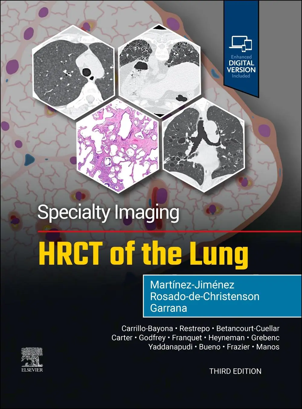 Cover: 9780443286360 | Specialty Imaging: HRCT of the Lung | Martínez-Jiménez (u. a.) | Buch