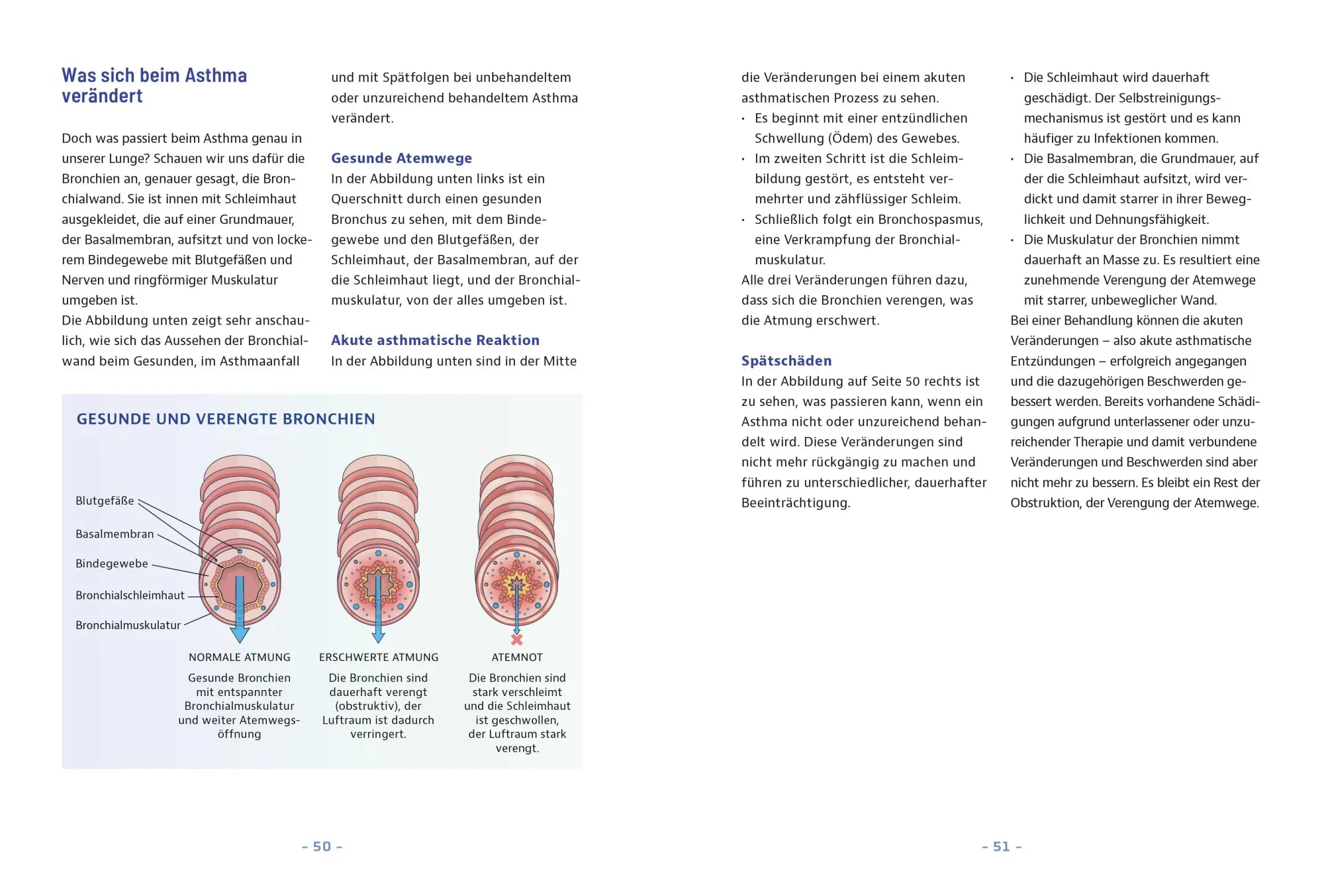 Bild: 9783965846760 | Besser leben mit Asthma und COPD | Thomas Hausen | Taschenbuch | 2026