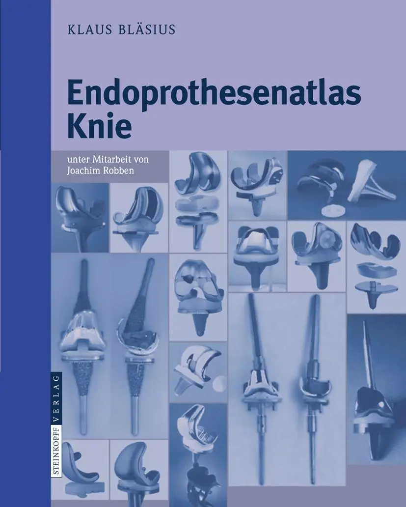 Cover: 9783798517660 | Endoprothesenatlas Knie | Klaus Bläsius | Taschenbuch | xxv | Deutsch